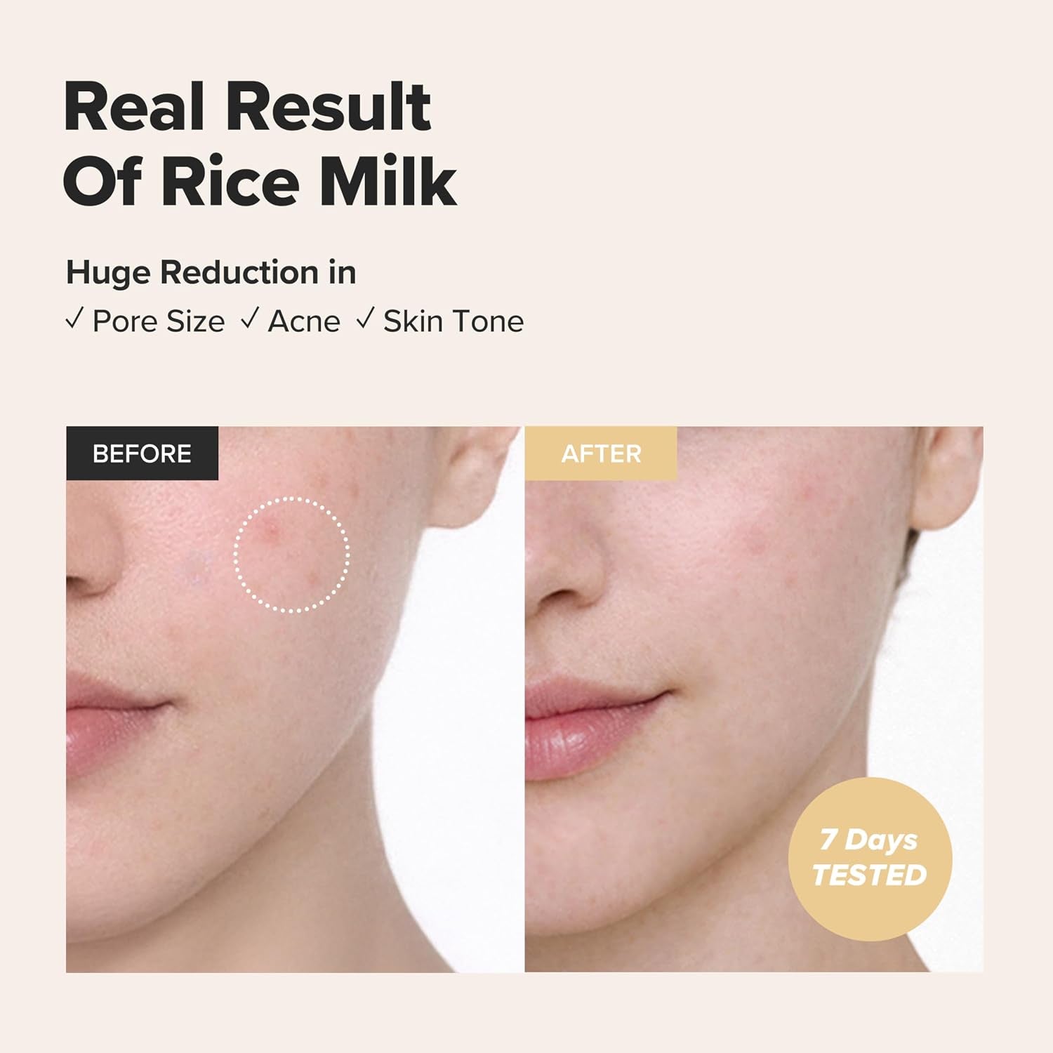 Glow Replenishing Rice Milk Toner Deep Hydration and Oil Control with Rice Extract Hydrating Korean Milky Toner for All Skin Types, 150Ml
