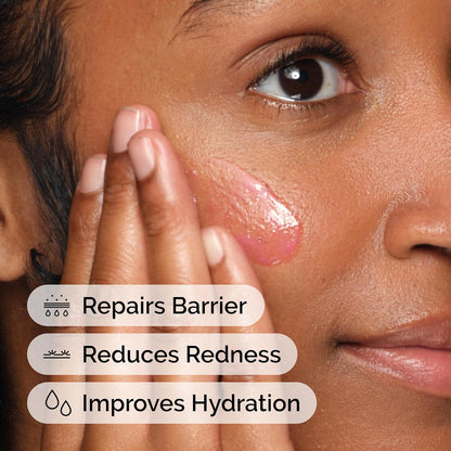 Soothing & Barrier Support Serum, Redness-Reducing & Hydrating Solution for Skin Barrier Recovery, 30Ml