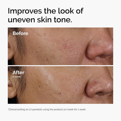 The Ordinary AHA 30% + BHA 2% Peeling Solution, Advanced Exfoliating Peel for Brighter Skin, 30Ml
